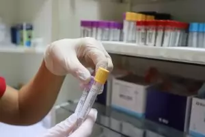 Английски учени ще смесят две ваксини срещу коронавирус