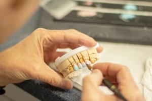 Проблемът с тоталните зъбни протези които трябва да са безплатни