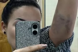 Жена разказа, че е станала жертва на полицейска бруталност