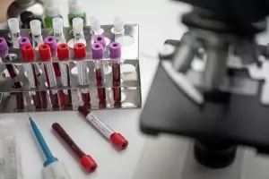 Moderna и Merck направиха пробив с
индивидуална ваксина срещу рак