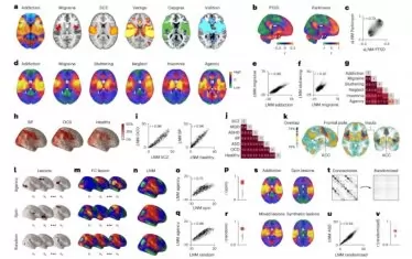 Ключово изследване на мозъка се оказа с проблеми